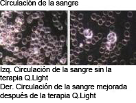 microcirculación